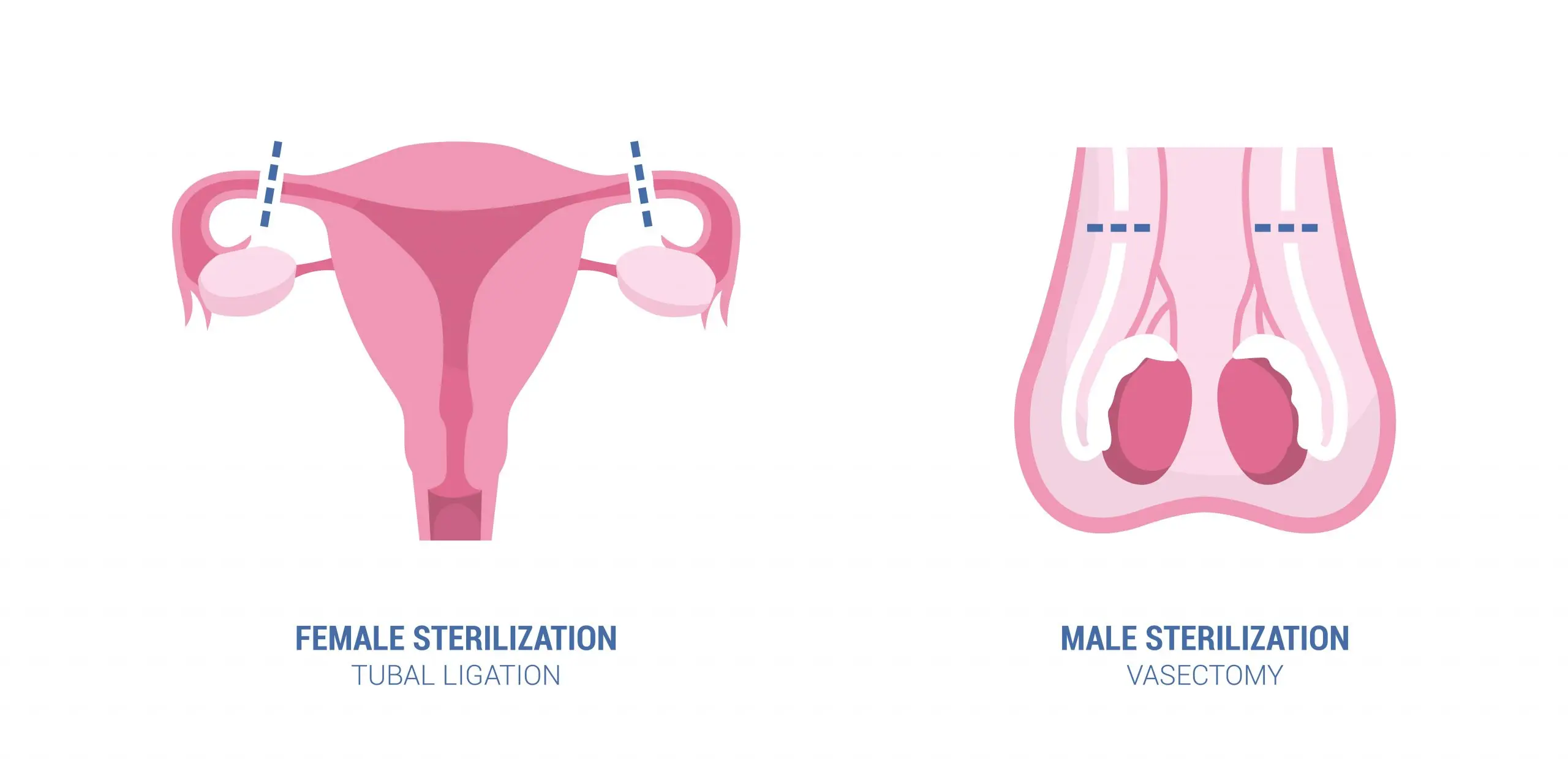 female male surgical sterilization scaled