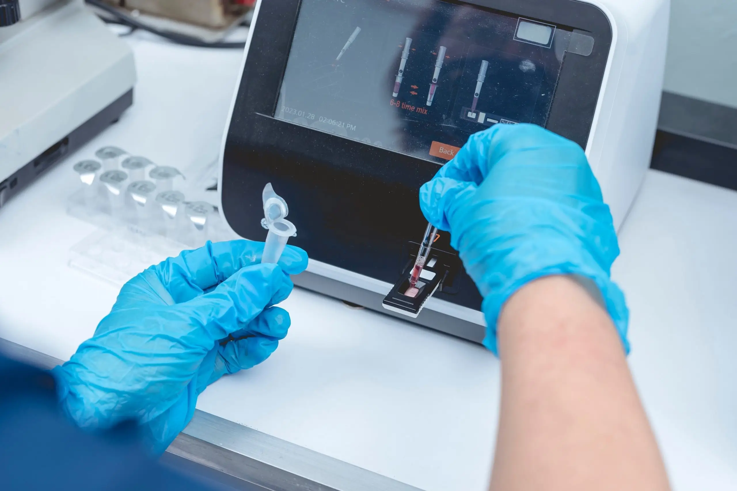 hba1c blood test screening process scaled