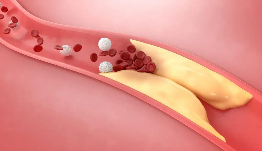 Rosuvastatin (โรซูวาสแตติน)