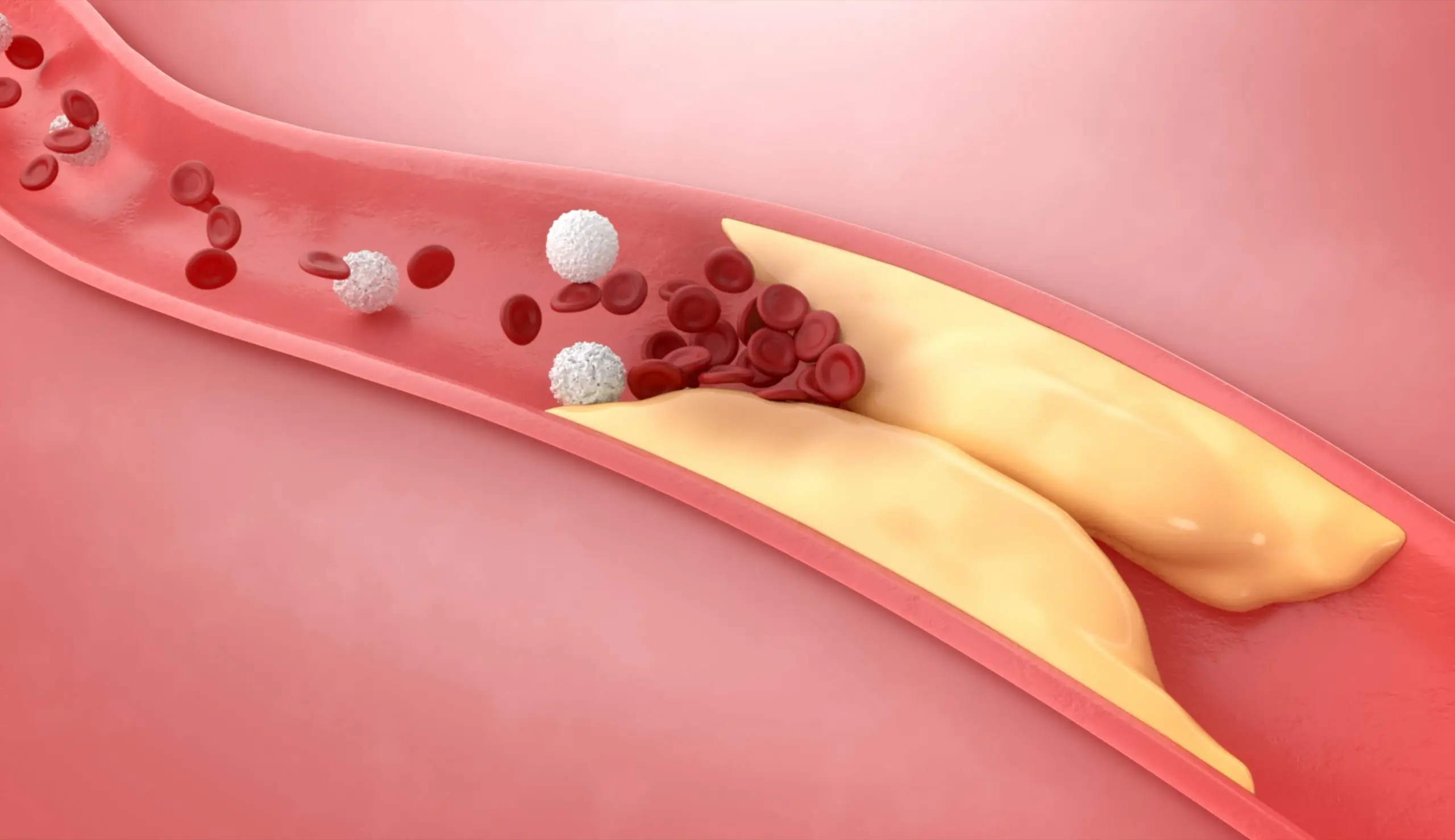 rosuvastatin scaled