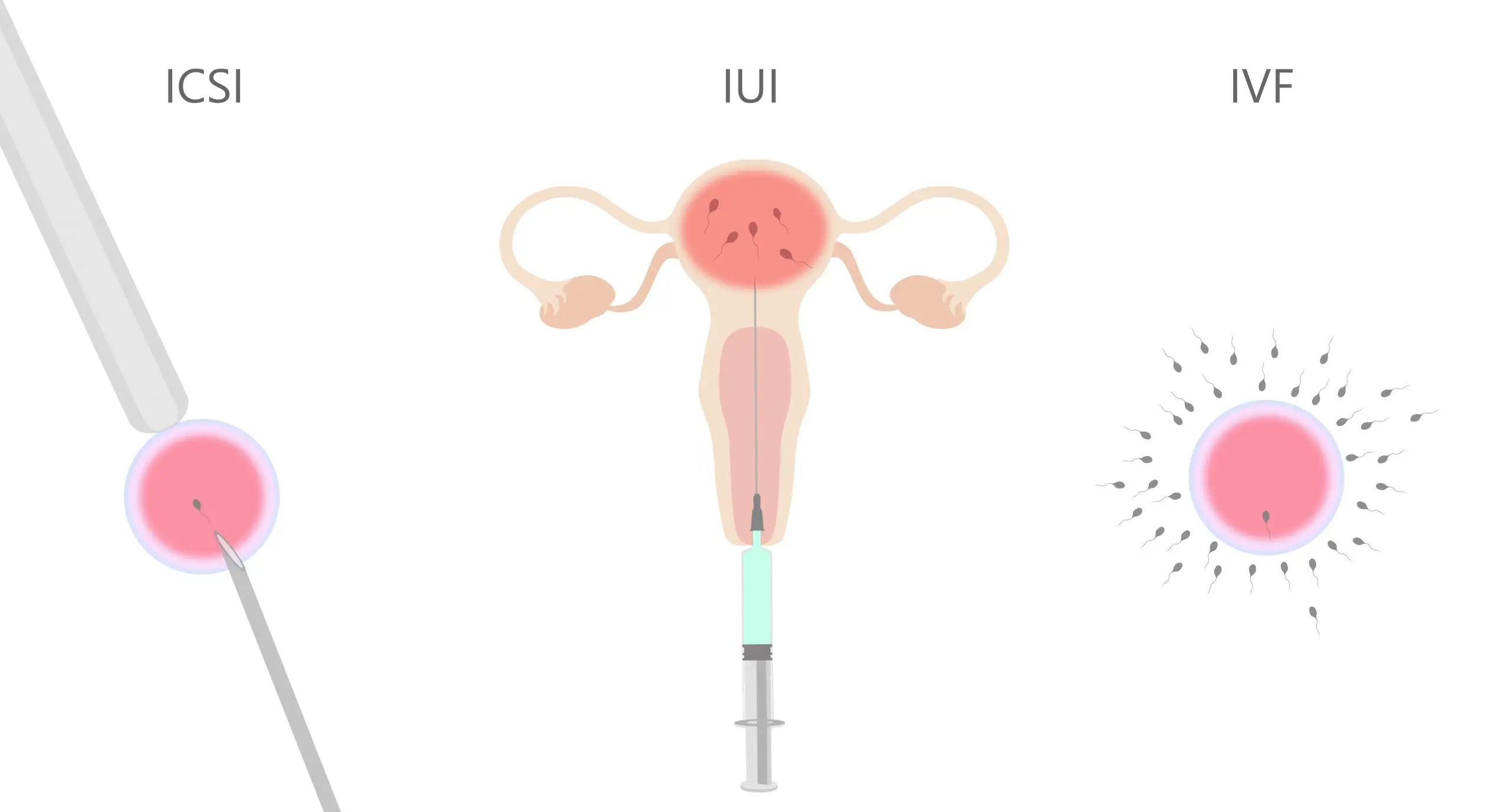 what is iui scaled