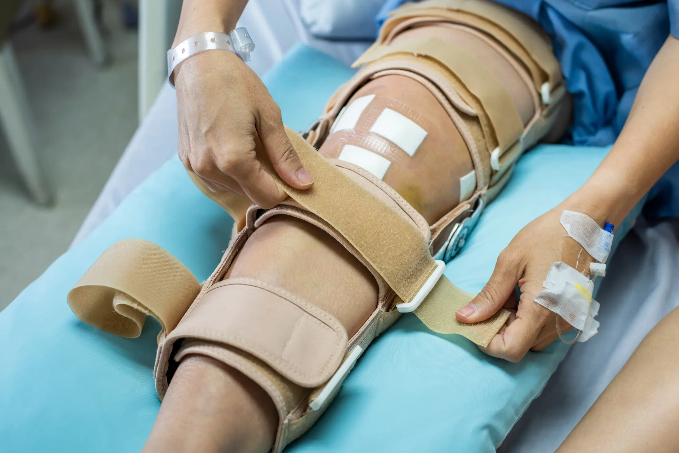 acl pcl surgery treatment faq