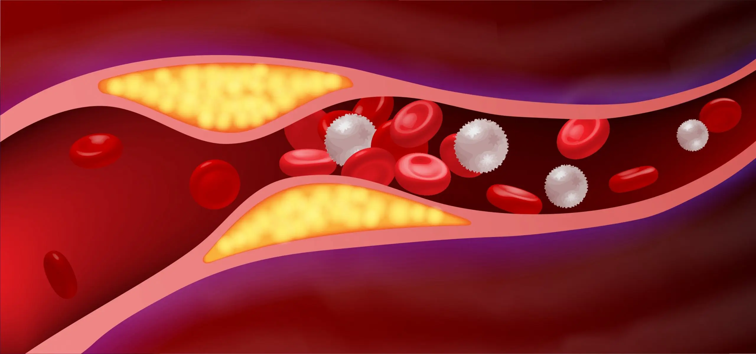 cardiovascular disease faq scaled