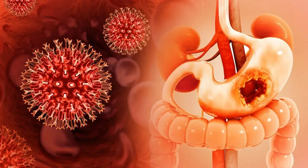รวม 8 เรื่องควรรู้ของมะเร็งกระเพาะอาหาร อาจใกล้ตัวกว่าที่คิด