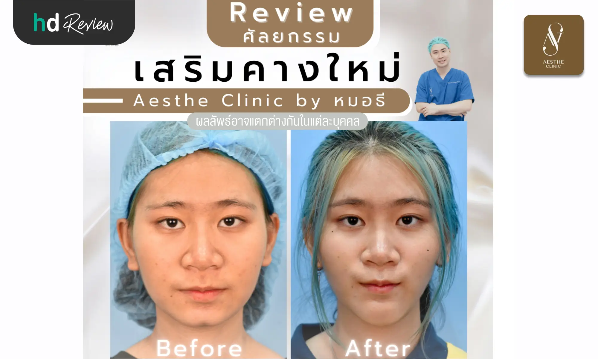 review before after Aesthe Clinic hero