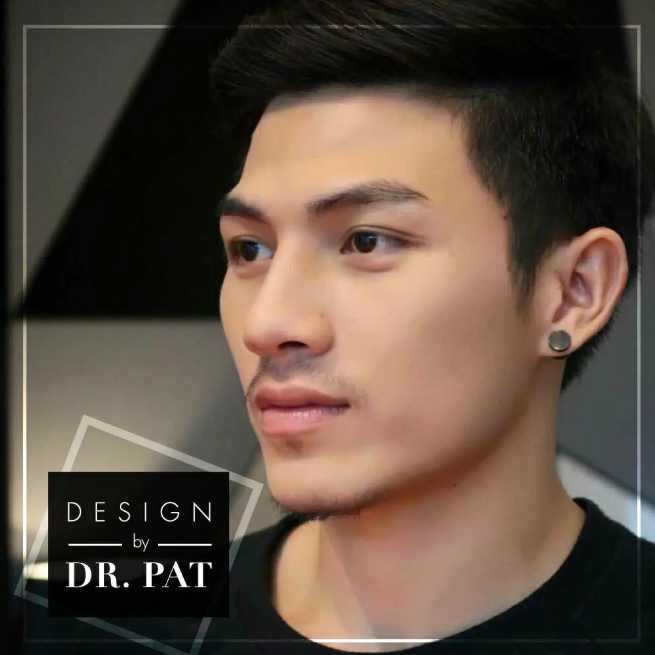 รีวิวทำจมูก เสริมจมูกผู้ชาย ที่ Bangkok Clinic & Design by Dr. Pat รูป 8