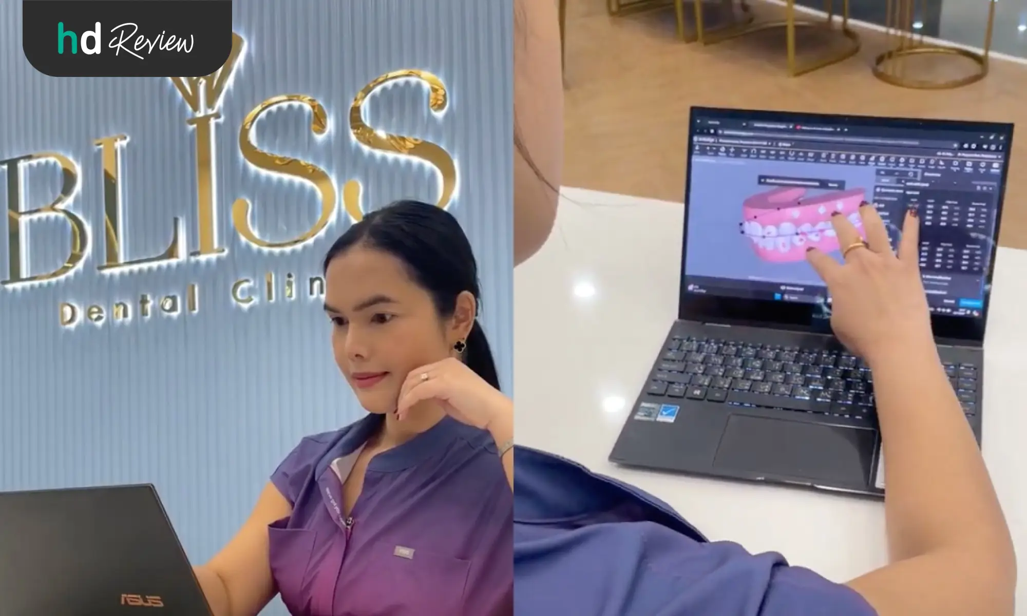 หมอบอลลูน Bliss Dental Clinic