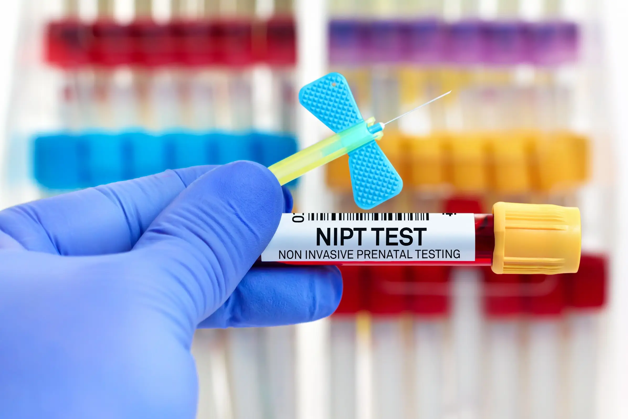 common questions about nipt test disease faq