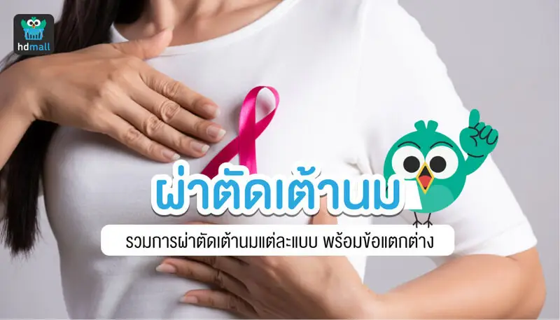 ผ่าตัดเต้านม