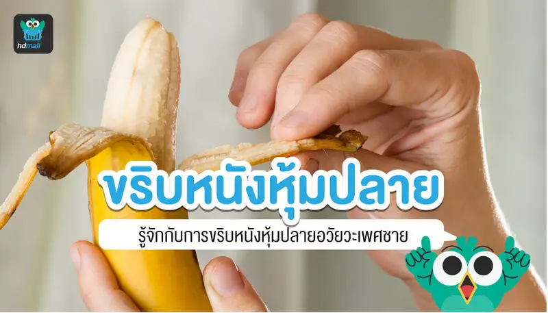 ขริบหนังหุ้มปลายอวัยวะเพศชาย (Circumcision)