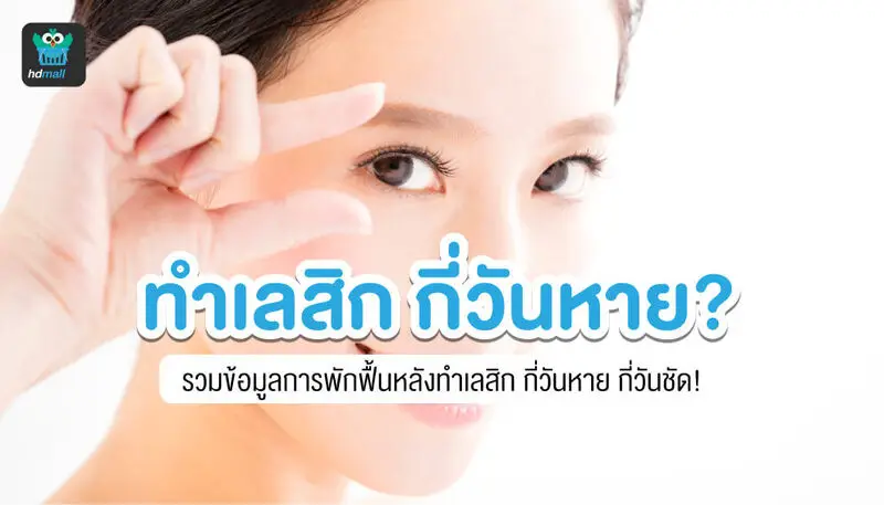 ทำเลสิก (LASIK)