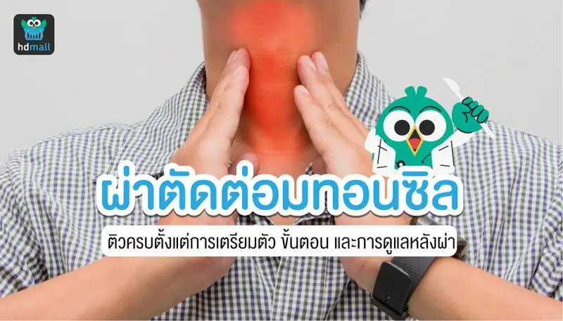 ผ่าตัดผ่าตัดต่อมทอนซิล