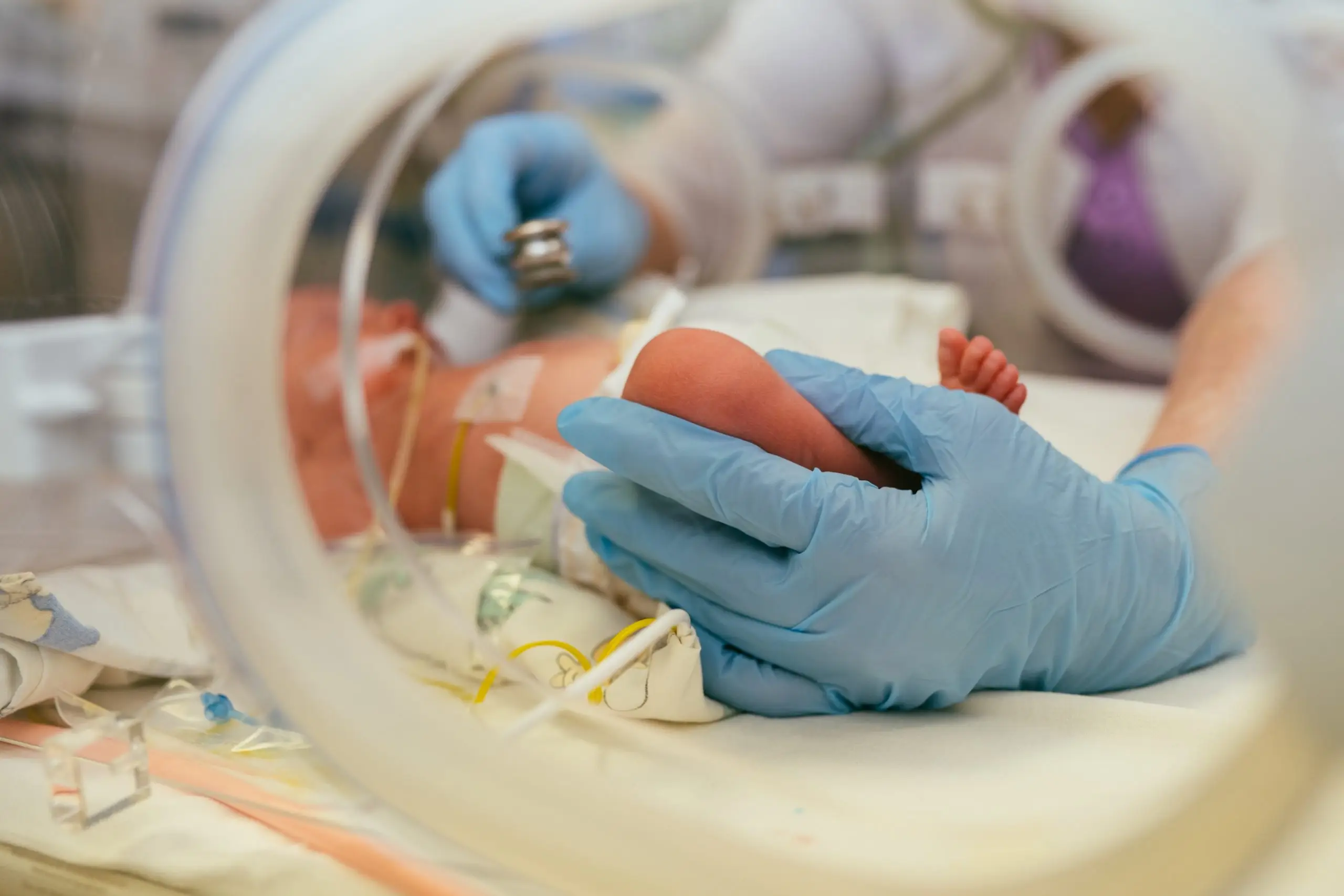 preterm labor risk and prevention disease definition scaled