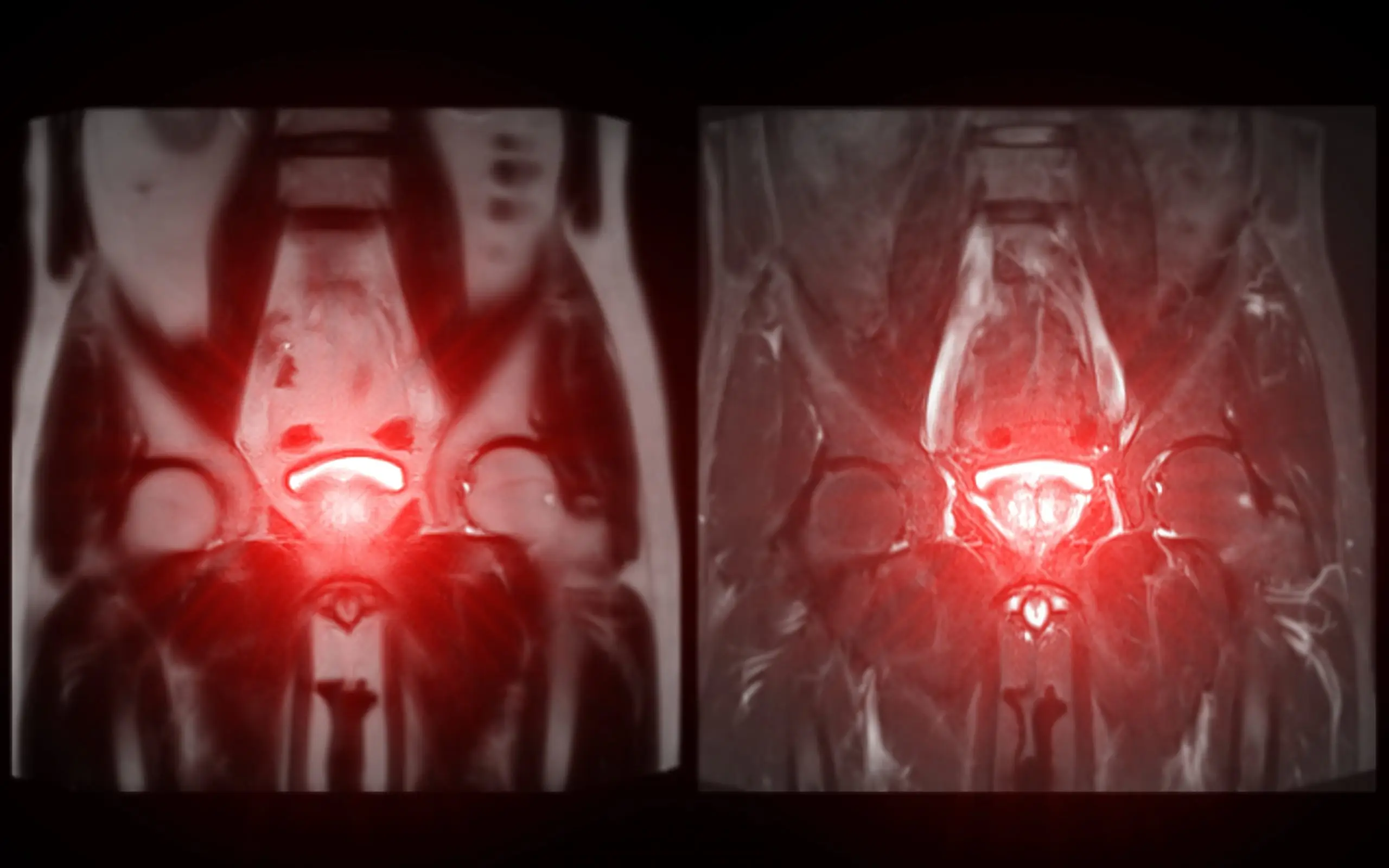 prostate disease faq scaled