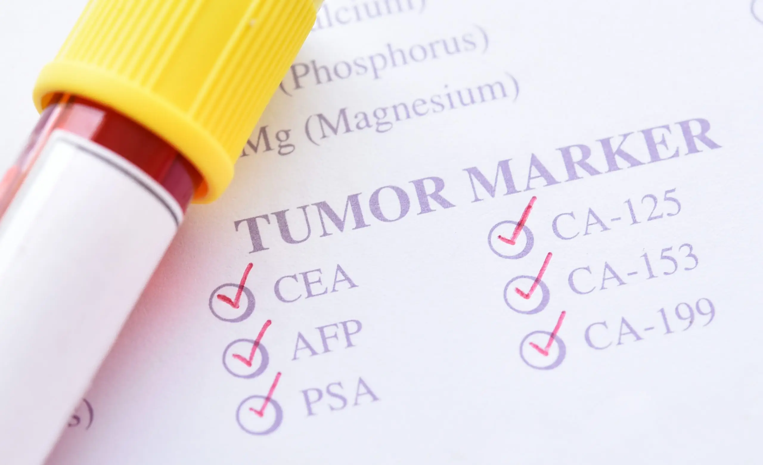 tumor markers test screening process scaled