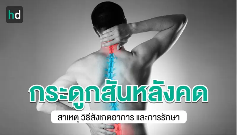 กระดูกสันหลังคด (Scoliosis)