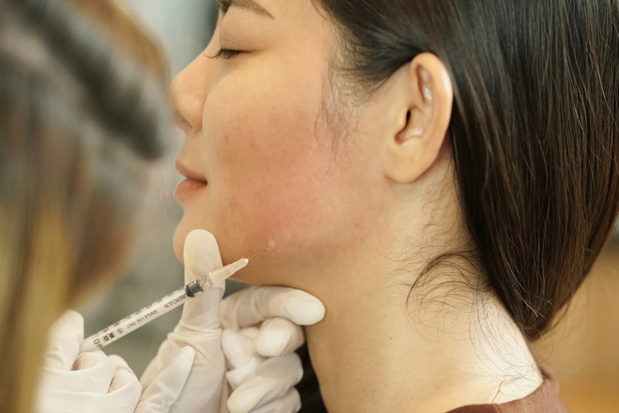 cosmetic uses of botulinum toxin treatment process