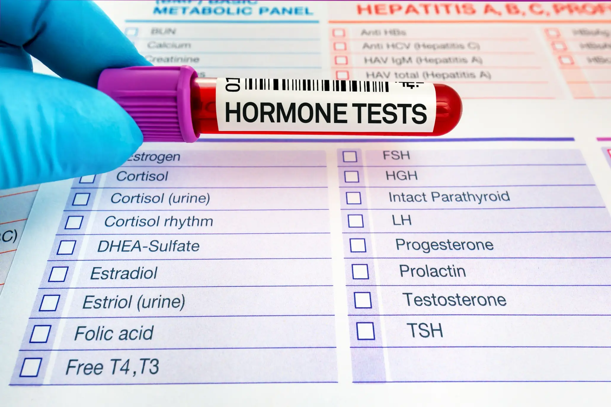 hormone levels testing questions screening faq