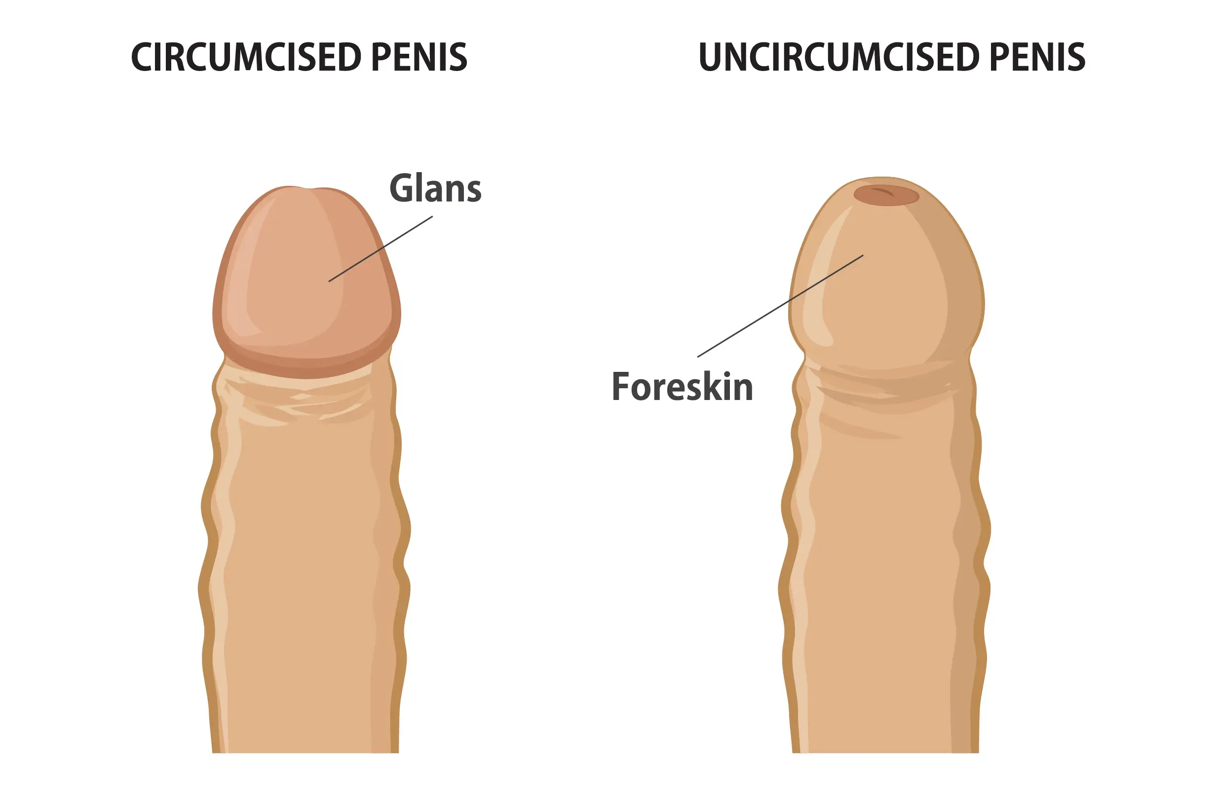 uncircumcised penis disease faq