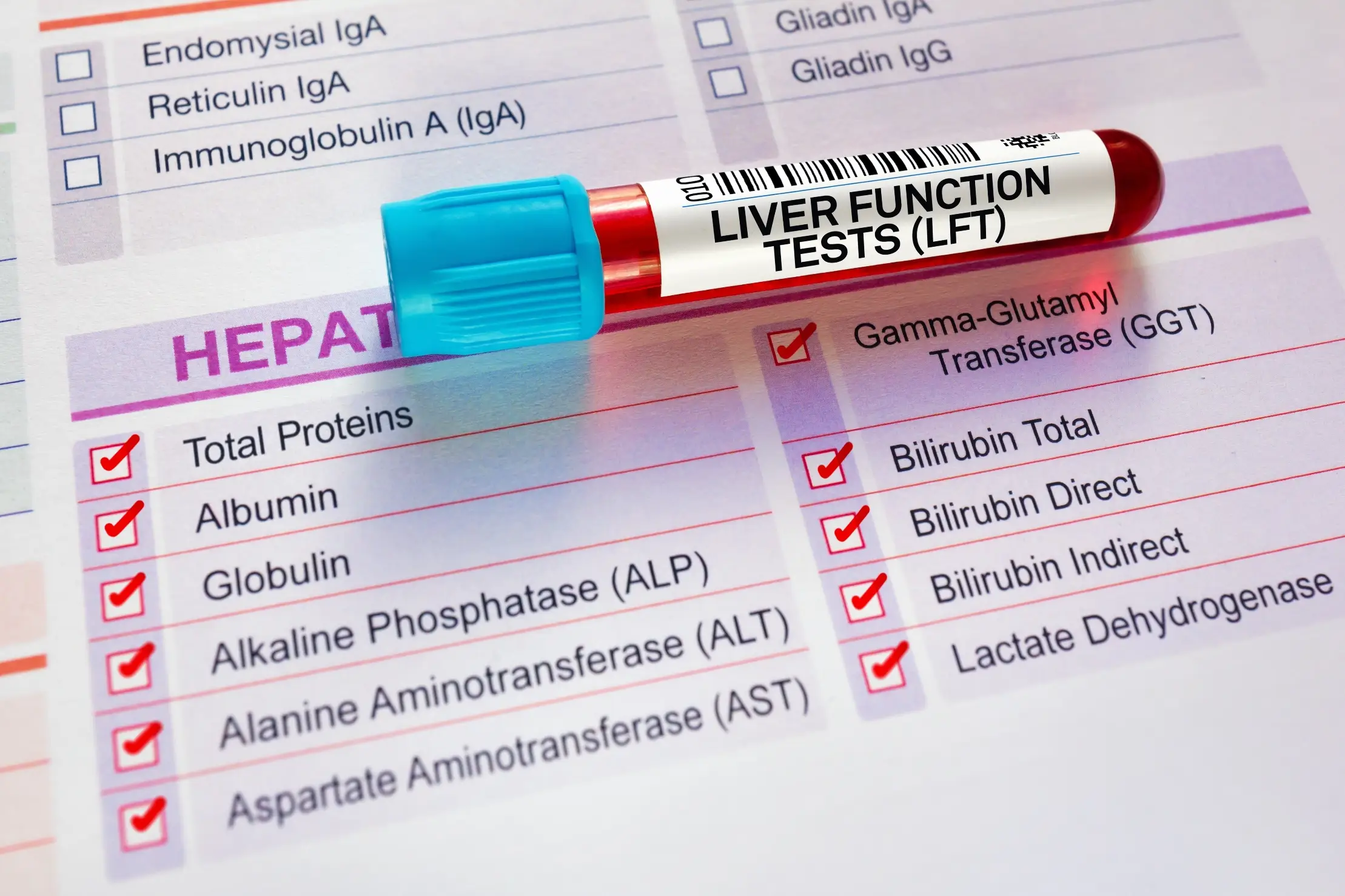 liver function tests screening process