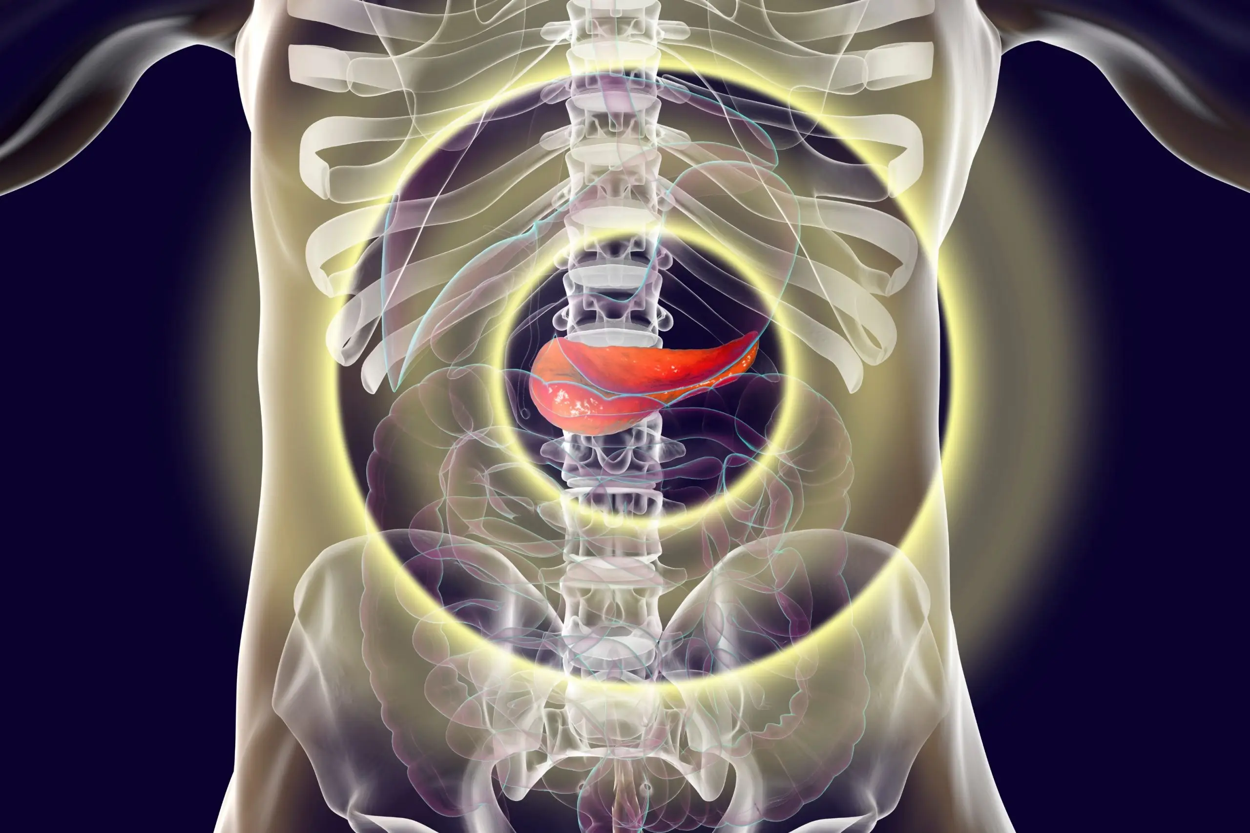 pancreatitis treatment process scaled