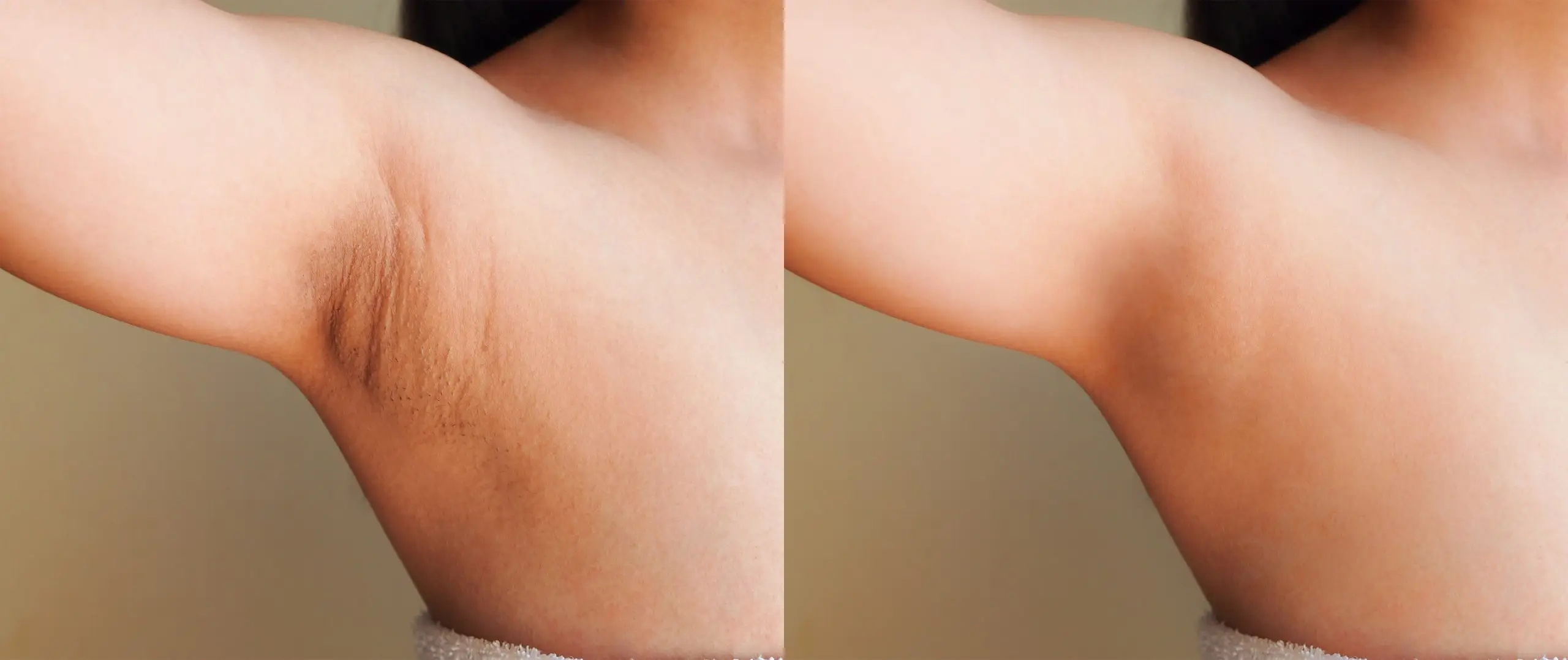 chicken skin armpit treatment how to scaled