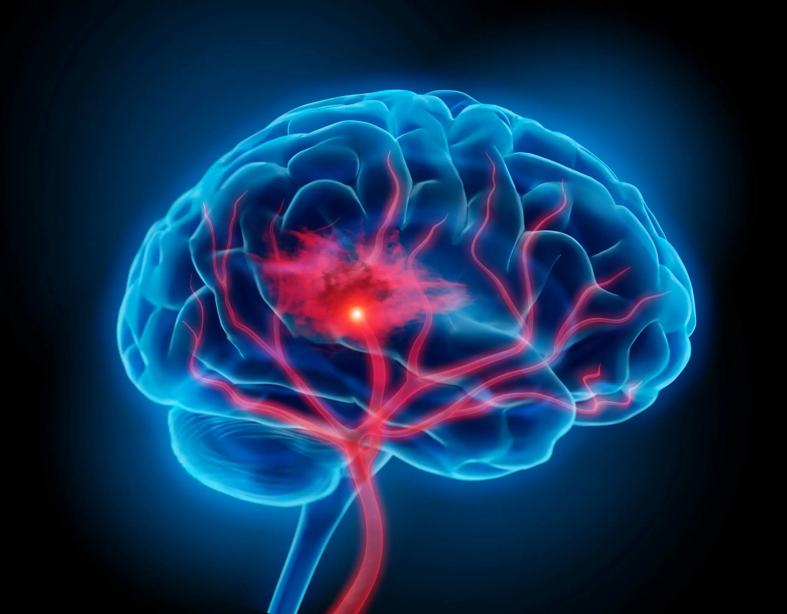 chronic headache screening process scaled