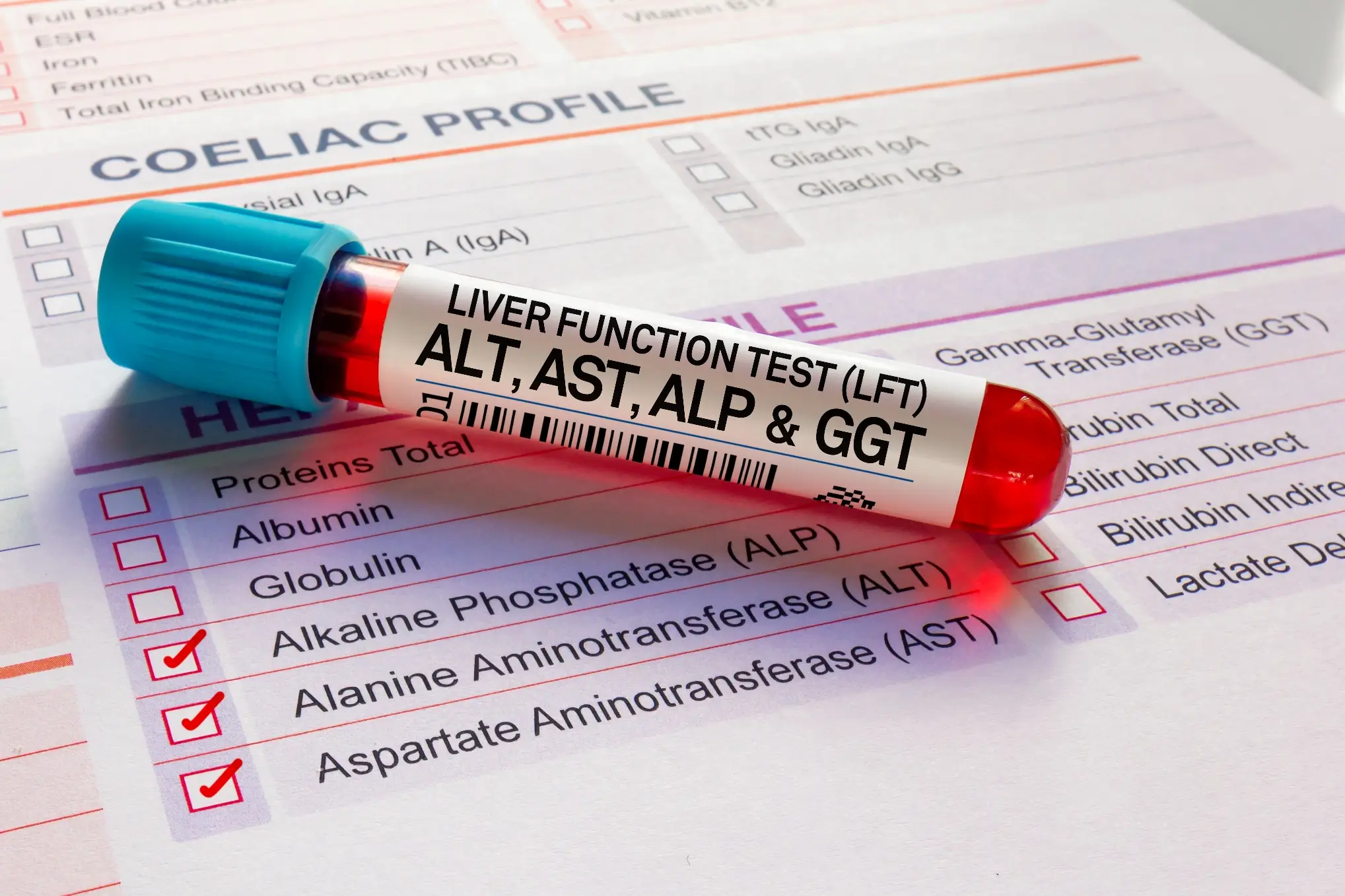 common liver blood tests screening process