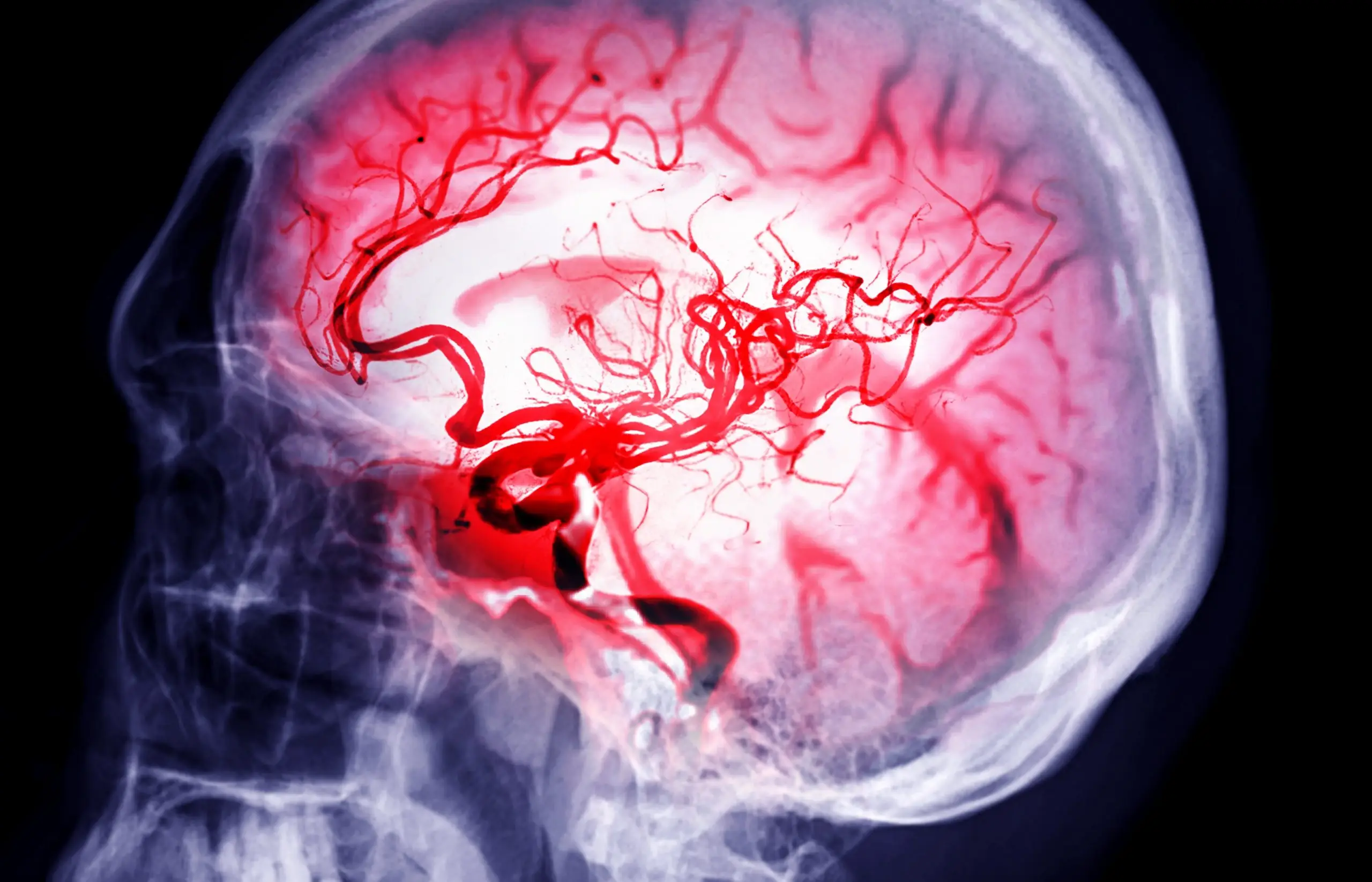 stroke behavior disease faq scaled