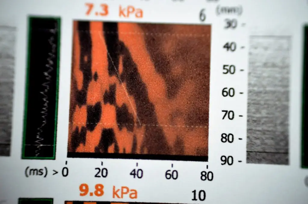 ใครเสี่ยงตับแข็ง ไขมันเกาะตับ ตรวจไฟโบรสแกน (Fibroscan) รู้ผลทันที ไม่เจ็บตัว