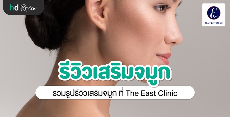 รีวิว เสริมจมูก ที่ The East Clinic