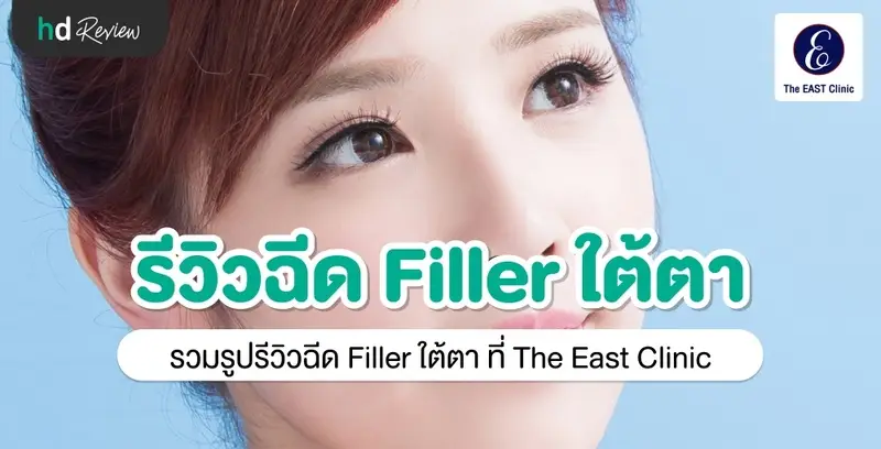 รีวิวฉีดฟิลเลอร์ใต้ตา ที่ The East Clinic