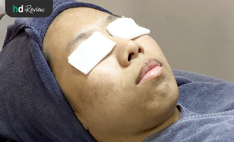 ทายารักษาสิว 9 ขั้นตอน ที่ Kawintra Clinic แบริ่ง