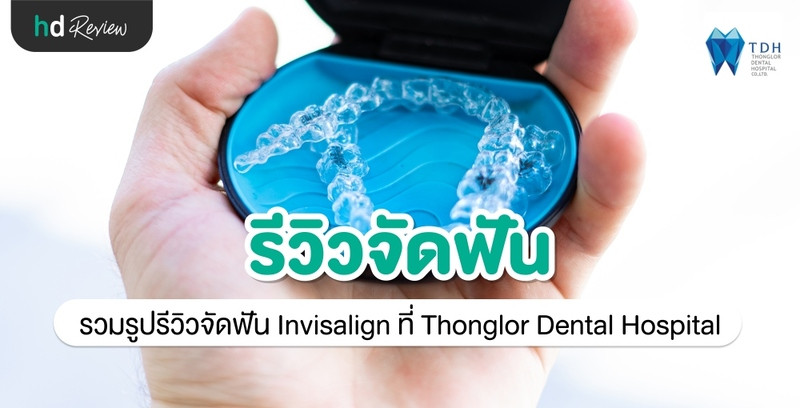 รีวิว จัดฟัน Invisalign ที่ Thonglor Dental Hospital (TDH)