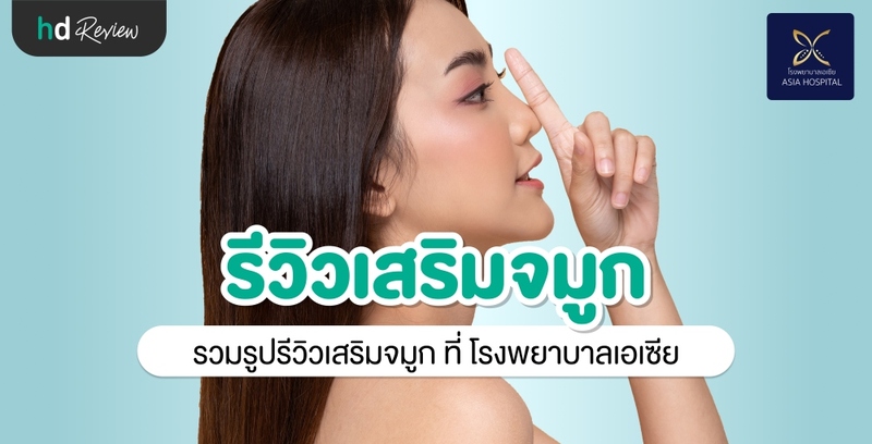 รีวิว เสริมจมูก ที่ โรงพยาบาลเอเซีย