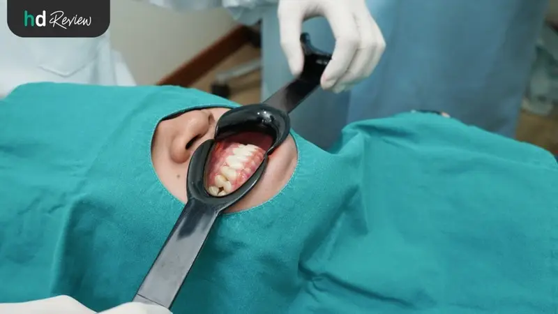 รีวิว จัดฟันแบบเซรามิก ที่ Grace Dental Clinic