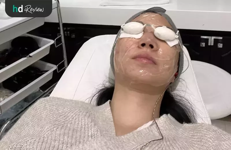 ขั้นการทำ Dual Yellow Laser ลดรอยสิว ที่ Pimtara Estetica Clinic