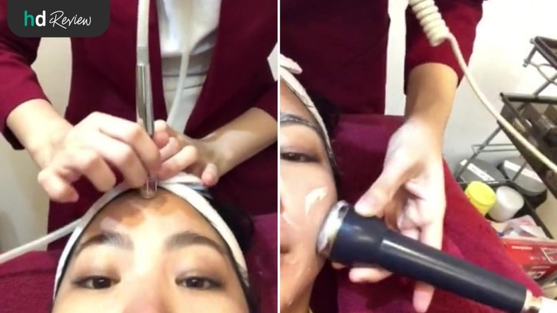 รีวิว ทรีตเมนต์หน้า ผลัดเซลล์ผิวด้วยเกล็ดอัญมณี ที่ KIHS Clinic