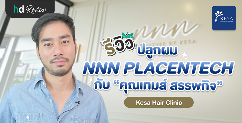 รีวิว ปลูกผม NNN PLACENTECH ที่ Kesa Hair Clinic กับ “คุณเทมส์ สรรพกิจ”