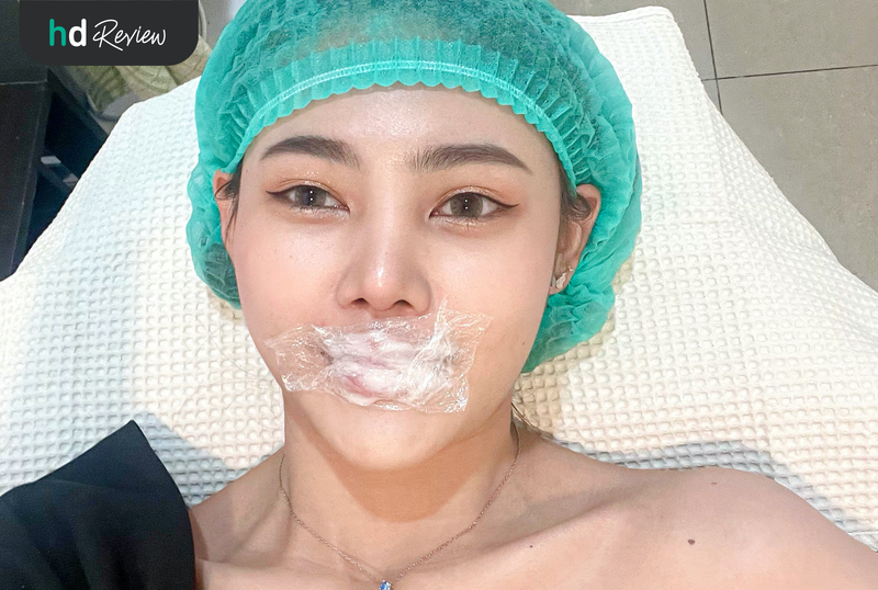 content review injectable fillers eptq 1 cc mouth at mine clinic by nuntaporn sarnkaew1