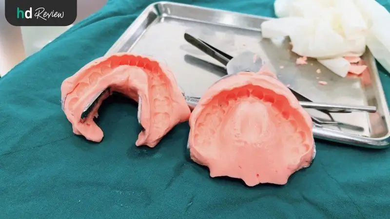 รีวิว ทำรีเทนเนอร์แบบลวด ที่ Tooth Box Dental Clinic