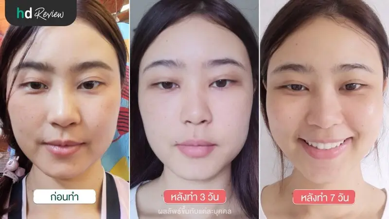 ผลลัพธ์หลังจากใช้บริการ