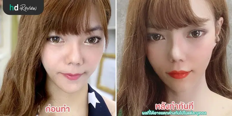 HDreview รีวิว สักปาก Microblading ที่ Baramee Beauty