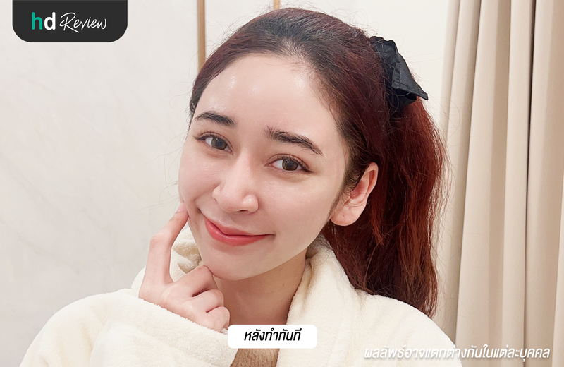 ผลลัพธ์ทำ Aqua pure
