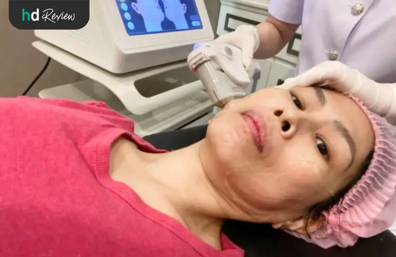 รีวิว ทำ HIFU Ultra Lift บริเวณแก้ม ที่ DPC Beauty Clinic