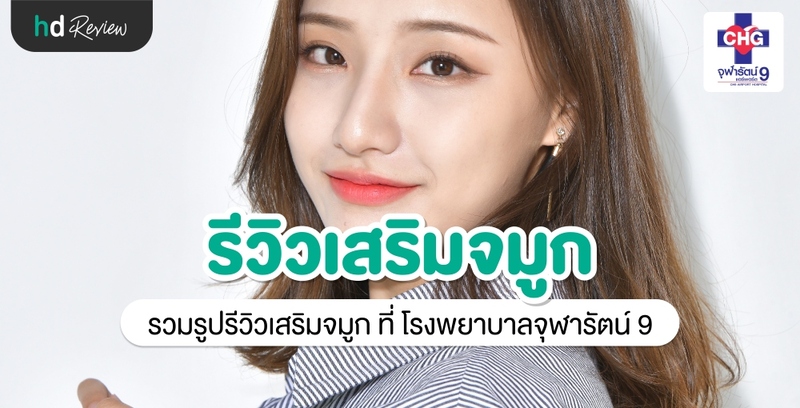 รีวิว เสริมจมูก ที่ โรงพยาบาลจุฬารัตน์ 9 แอร์พอร์ต