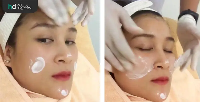 ขั้นตอนการฝังเข็มหน้าใส ที่ Mandarin Clinic