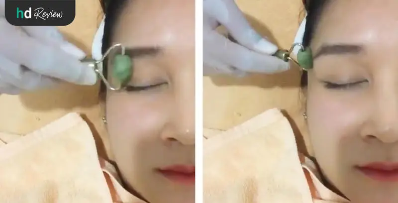 ขั้นตอนการฝังเข็มหน้าใส ทรีตเมนต์กัวซา ที่ Mandarin Clinic