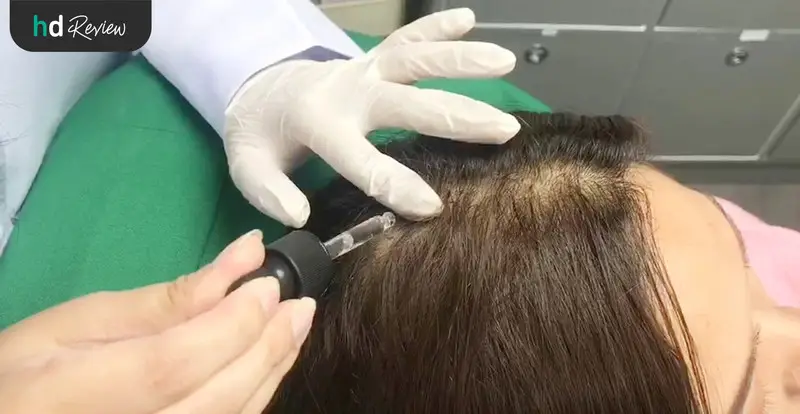 รีวิวเลเซอร์กระตุ้นรากผม Hair Growth Laser ที่ GROW & GLOW Clinic 7 รีวิวเลเซอร์กระตุ้นรากผม Hair Growth Laser ที่ Glow & Glow Clinic