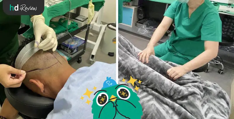 ขั้นตอนการปลูกผม ด้วยเทคนิค FUE ที่ GROW & Clinic วันที่ 2
